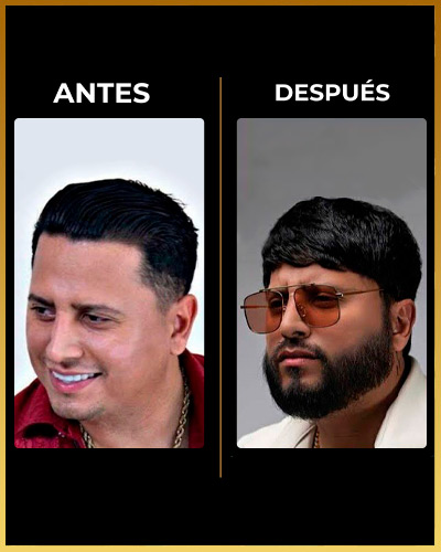 Los Reyes Del Injerto - Testimonio injerto de Barba 12