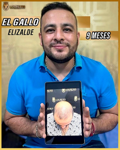 Los Reyes Del Injerto - Testimonio injerto de Cabello El Gallo Elizalde
